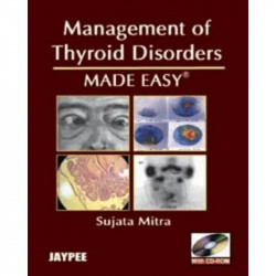 Management of Thyroid Disorders Made Easy with CD-ROM book by Mitra Sujata