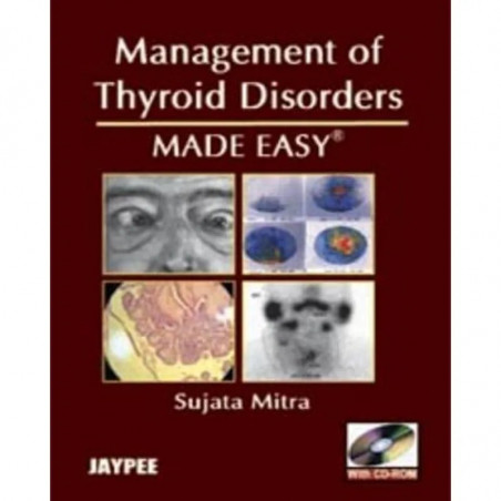 Management of Thyroid Disorders Made Easy with CD-ROM book by Mitra Sujata