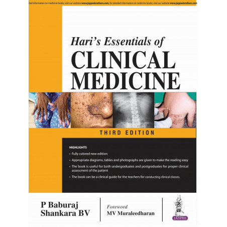 Hari’s Essentials of Clinical Medicine book by P Baburaj, Shankara BV