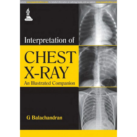 Interpretation of Chest X-ray: An Illustrated Companion book by G. Balachandran