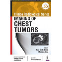 CLINICO RADIOLOGICAL SERIES: IMAGING OF CHEST TUMORS book by Ashu Seith Bhalla, Manisha Jana
