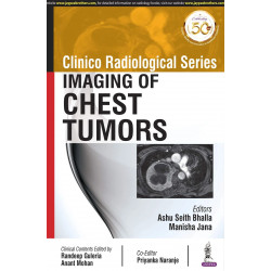 CLINICO RADIOLOGICAL SERIES: IMAGING OF CHEST TUMORS book by Ashu Seith Bhalla, Manisha Jana