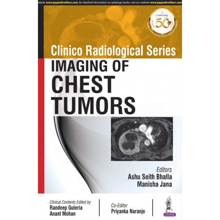 CLINICO RADIOLOGICAL SERIES: IMAGING OF CHEST TUMORS book by Ashu Seith Bhalla, Manisha Jana
