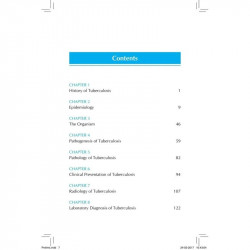 Clinic Consult Pulmonology: Tuberculosis (POD) book by M.D. Behera, Digambar - Back Cover