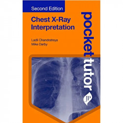 Chest X-Ray Interpretation (Pocket Tutor) (POD) book by Mike Darby Ladli Chandratreya - Back Cover