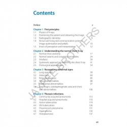Chest X-Ray Interpretation (Pocket Tutor) (POD) book by Mike Darby Ladli Chandratreya - Additional Image 4