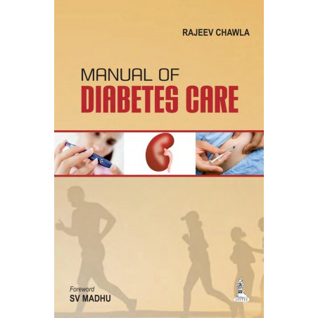 MANUAL OF DIABETES CARE book by Chawla Rajeev