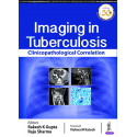 Imaging in Tuberculosis: Clinicopathological Correlation (POD) book by Rakesh K Gupta, Raju Sharma
