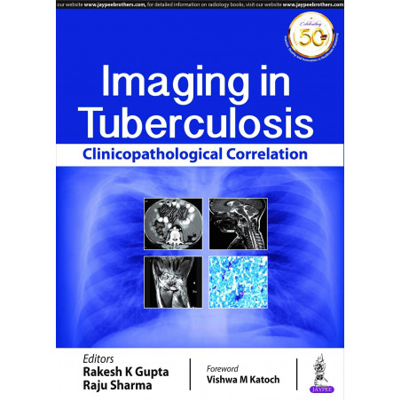 Imaging in Tuberculosis: Clinicopathological Correlation (POD) book by Rakesh K Gupta, Raju Sharma