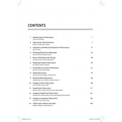 Imaging in Tuberculosis: Clinicopathological Correlation (POD) book by Rakesh K Gupta, Raju Sharma - Additional Image 5