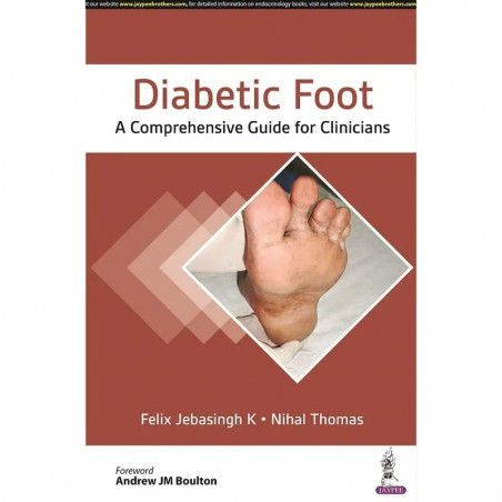 Diabetic Foot: A Comprehensive Guide for Clinicians | Multidisciplinary Reference on Diabetic Foot Ulcers, Charcot Foot, Ost…