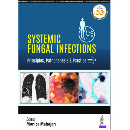 SYSTEMIC FUNGAL INFECTIONS: PRINCIPLES, PATHOGENESIS & PRACTICE book by Monica Mahajan, microbiologists This book is an ende…