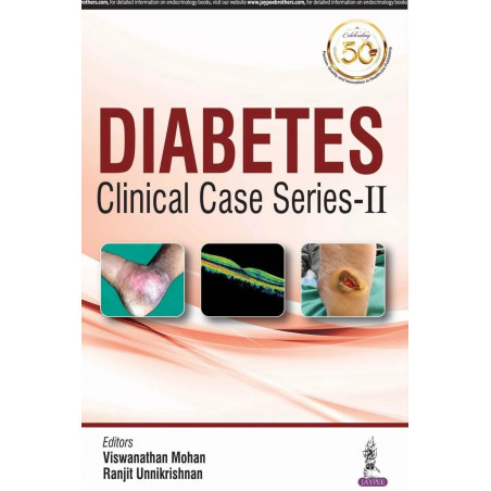 Diabetes Clinical Case Series – II book by Mohan Viswanathan