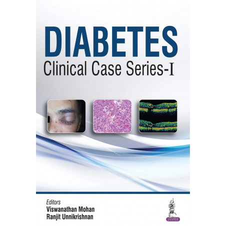 Diabetes: Clinical Case Series-I book by Viswanathan Mohan, Ranjit Unnikrishnan