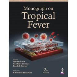 Monograph on Tropical Fever book by Jyotirmoy Pal, Nandini Chatterjee