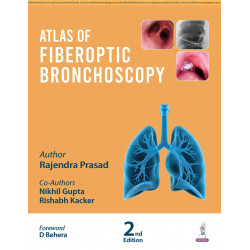 ATLAS OF FIBEROPTIC BRONCHOSCOPY book by Rajendra Prasad, Nikhil Gupta
