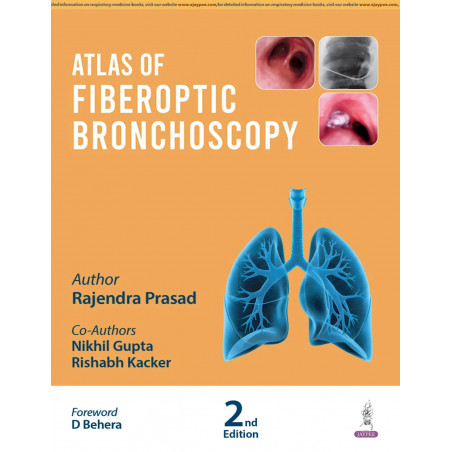ATLAS OF FIBEROPTIC BRONCHOSCOPY book by Rajendra Prasad, Nikhil Gupta