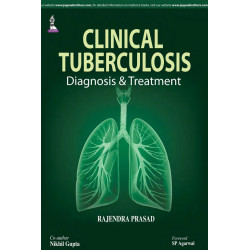 Clinical Tuberculosis: Diagnosis & Treatment book by Prasad Rajendra