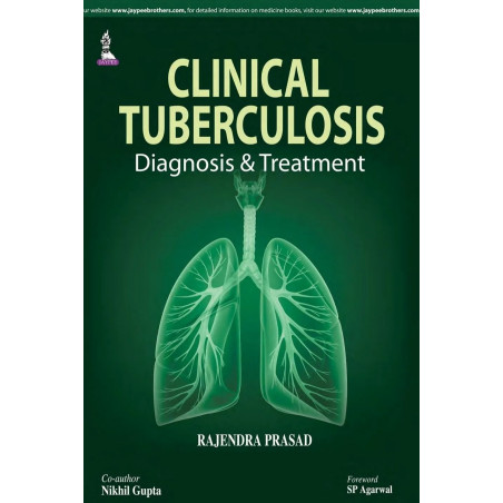 Clinical Tuberculosis: Diagnosis & Treatment book by Prasad Rajendra