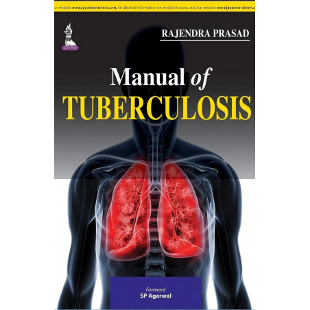 Manual of Tuberculosis book by Prasad Rajendra