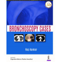 Bronchoscopy Cases (POD) book by Raj Kumar