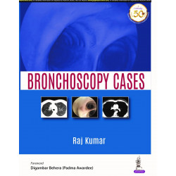 Bronchoscopy Cases (POD) book by Raj Kumar