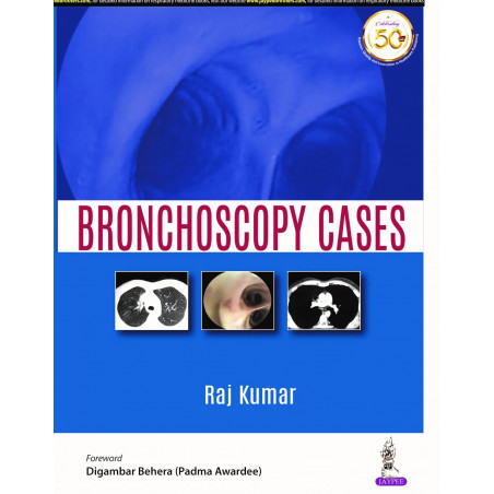 Bronchoscopy Cases (POD) book by Raj Kumar