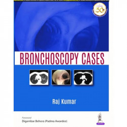 Bronchoscopy Cases (POD) book by Raj Kumar - Back Cover