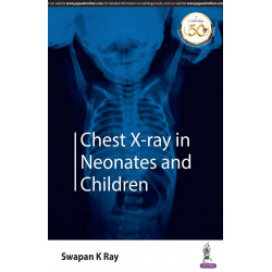 Chest X-ray in Neonates and Children book by Swapan K Ray