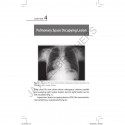 Chest X-ray in Neonates and Children book by Swapan K Ray - Additional Image 5