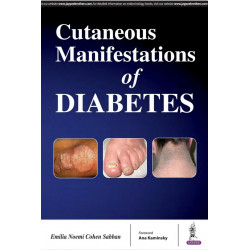 Cutaneous Manifestations of Diabetes book by Emilia Noemí Cohen Sabban