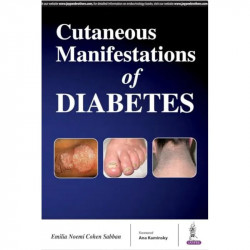 Cutaneous Manifestations of Diabetes book by Emilia Noemí Cohen Sabban - Back Cover