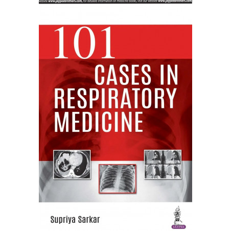 101 Cases in Respiratory Medicine book by Supriya Sarkar