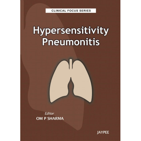 HYPERSENSITIVITY PNEUMONITIS: CLINICAL FOCUS SERIES book by Sharma