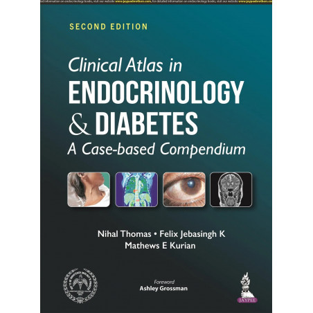 Clinical Atlas in Endocrinology & Diabetes: A Case-Based Compendium book by Nihal Thomas, Felix Jebasingh K