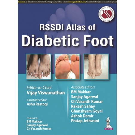RSSDI Atlas of Diabetic Foot book by Vijay Viswanathan, Ashu Rastogi