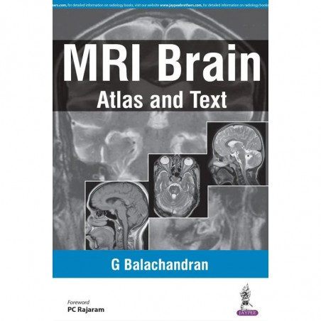 MRI Brain: Atlas and Text (POD) book by Balachandran G