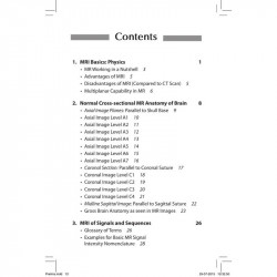 MRI Brain: Atlas and Text (POD) book by Balachandran G - Additional Image 3