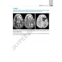 ATLAS OF NEUROLOGY A CASE BASED APPROACH book by Kalyan B Bhattacharyya, Satish V Khadilkar - Additional Image 6