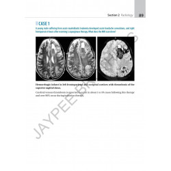 ATLAS OF NEUROLOGY A CASE BASED APPROACH book by Kalyan B Bhattacharyya, Satish V Khadilkar - Additional Image 6