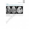 ATLAS OF NEUROLOGY A CASE BASED APPROACH book by Kalyan B Bhattacharyya, Satish V Khadilkar - Additional Image 7