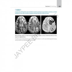 ATLAS OF NEUROLOGY A CASE BASED APPROACH book by Kalyan B Bhattacharyya, Satish V Khadilkar - Additional Image 7