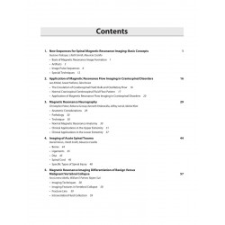 SPINAL IMAGING CRITICAL TOPICS FOR CLINICAL PRACTICE book by Castillo Mauricio - Additional Image 5