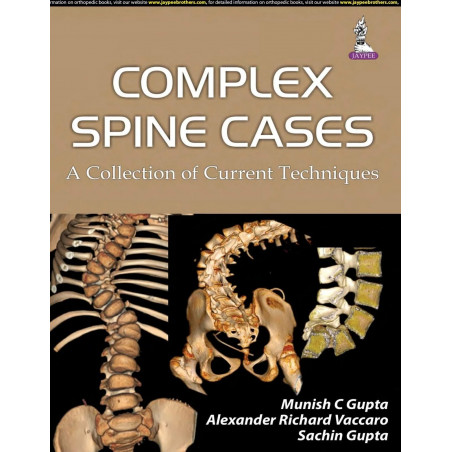 Complex Spine Cases: A Collection of Current Techniques (POD) book by Gupta Manisha C