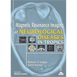 MAGNETIC RESONANCE IMAGING OF NEUROLOGICAL DISEASES IN TROPICS book