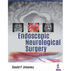 Endoscopic Neurological Surgery book by David F. Jimenez