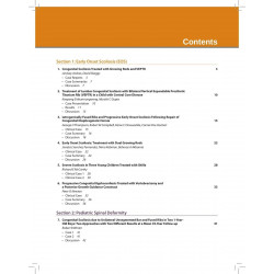 Complex Spine Cases: A Collection of Current Techniques (POD) book by Gupta Manisha C - Additional Image 5
