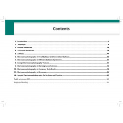 MANUAL OF PEDIATRIC EEG book by Praveen Kumar - Additional Image 5