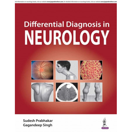 Differential Diagnosis in Neurology book by Prabhakar Sudesh