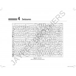 NEUROSCIENCE EEG ATLAS book by Nundy Amitabh - Additional Image 6